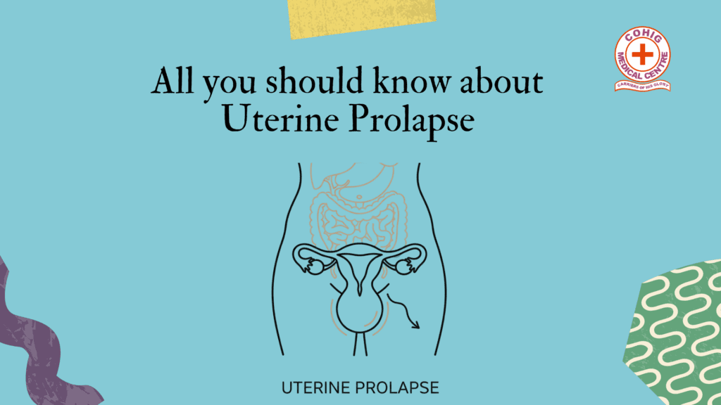 An educational graphic titled "All you should know about Uterine Prolapse" on a light blue background. The top right corner features a red and white circular logo for "COHIG MEDICAL CENTRE". In the center is a minimalist line drawing of a female torso silhouette showing the internal reproductive organs, specifically illustrating a uterine prolapse with an arrow pointing downward. The bottom of the image includes the text "UTERINE PROLAPSE" in a clean, sans-serif font. Abstract purple and green shapes frame the bottom corners of the graphic.